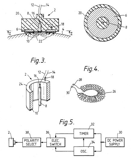 US4915110